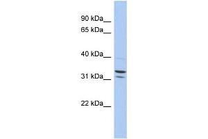 WB Suggested Anti-FAM92B Antibody Titration: 0. (FAM92B antibody  (N-Term))