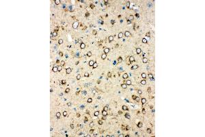 Anti-MTCO1 antibody,  IHC(P) IHC(P): Rat Brain Tissue (COX1 antibody  (N-Term))