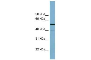 CDK5RAP1 antibody used at 1 ug/ml to detect target protein.