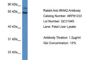 Western Blotting (WB) image for anti-Interleukin-1 Receptor-Associated Kinase 2 (IRAK2) (C-Term) antibody (ABIN2788725)