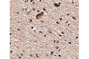 Immunohistochemistry (IHC) image for anti-Sprouty-Related, EVH1 Domain Containing 1 (SPRED1) (Middle Region 2) antibody (ABIN1031204) (SPRED1 antibody  (Middle Region 2))