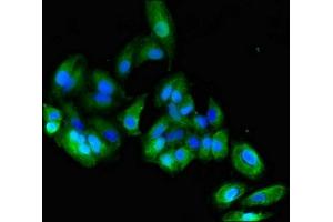 Immunofluorescent analysis of HepG2 cells using ABIN7146803 at dilution of 1:100 and Alexa Fluor 488-congugated AffiniPure Goat Anti-Rabbit IgG(H+L) (CEACAM6 antibody  (AA 35-320))