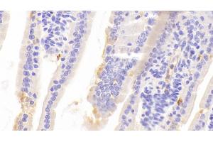Immunohistochemistry (IHC) image for anti-Chromogranin A (CHGA) (AA 24-154) antibody (ABIN7443716)