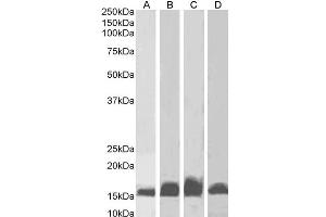 ABIN184738 (1µg/ml) staining of Human Frontal Cortex (A), Rat Brain (B), Mouse (C) Brain and Pig Brain (D) lysates (35µg protein in RIPA buffer). (Iba1 antibody  (C-Term))