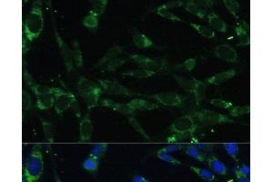 Immunofluorescence analysis of NIH-3T3 cells using CAPN5 Polyclonal Antibody at dilution of 1:100.