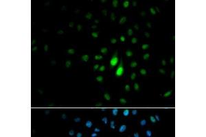 Immunofluorescence analysis of MCF-7 cells using PIN1 Polyclonal Antibody (PIN1 antibody)