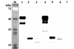 Western blot analysis using anti-FGF-21 (human), mAb (FG224-7)  at 1:2'000 dilution. (FGF21 antibody)