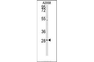 Image no. 1 for anti-Protein Kinase C, delta Binding Protein (PRKCDBP) (Middle Region) antibody (ABIN360096) (PRKCDBP antibody  (Middle Region))