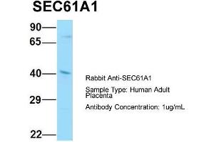 Host: Rabbit  Target Name: SEC61A1  Sample Tissue: Human Adult Placenta  Antibody Dilution: 1. (SEC61A1 antibody  (C-Term))