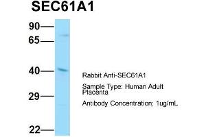 Host: Rabbit  Target Name: SEC61A1  Sample Tissue: Human Adult Placenta  Antibody Dilution: 1.