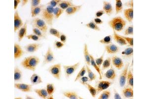 ICC testing of HeLa cells (DCI antibody  (C-Term))