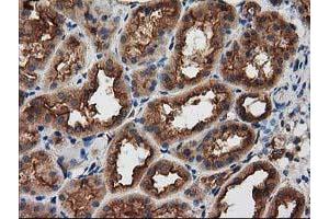 Immunohistochemical staining of paraffin-embedded Human Kidney tissue using anti-PRKAR2A mouse monoclonal antibody. (PRKAR2A antibody)