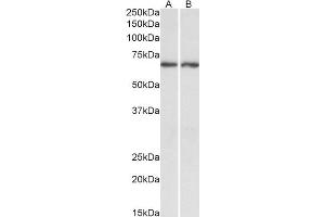 Antibody (0. (Acetylcholinesterase antibody  (C-Term))