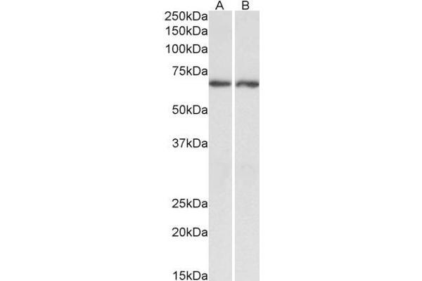 Acetylcholinesterase antibody  (C-Term)