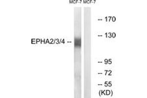 Western blot analysis of extracts from MCF-7 cells, using EPHA2/3/4 (Ab-588/596) Antibody.