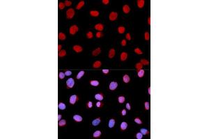Immunofluorescence (IF) image for anti-Minichromosome Maintenance Complex Component 6 (MCM6) (AA 562-821) antibody (ABIN6219105) (MCM6 antibody  (AA 562-821))