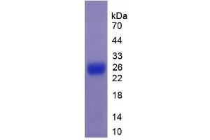 SDS-PAGE analysis of Mouse Mucin 5B Protein. (MUC5B Protein)
