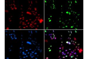 Immunofluorescence analysis of GFP-RNF168 transgenic U2OS cells using PI antibody (ABIN6128449, ABIN6145593, ABIN6145595 and ABIN6221396). (PIAS1 antibody  (AA 422-651))
