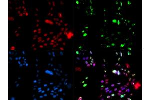 Immunofluorescence analysis of GFP-RNF168 transgenic U2OS cells using PI antibody (ABIN6128449, ABIN6145593, ABIN6145595 and ABIN6221396). (PIAS1 antibody  (AA 422-651))