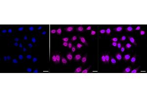 anti-Chromosome 3 Open Reading Frame 38 (C3orf38) antibody