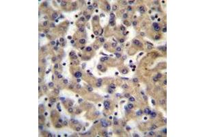 Immunohistochemistry analysis in formalin fixed and paraffin embedded human liver tissue reacted with PDP1 Antibody (Center) followed by peroxidase conjugation of the secondary antibody and DAB staining.