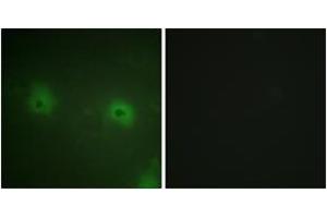 Immunofluorescence analysis of HuvEc cells, using STAM2 (Ab-192) Antibody. (STAM2 antibody  (AA 161-210))
