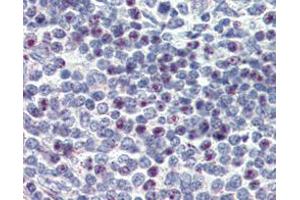 Immunohistochemical analysis of paraffin-embedded human spleen using CD34 mouse mAb with DAB staining. (CD34 antibody)