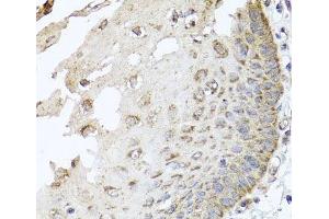 Immunohistochemistry of paraffin-embedded Human esophagus using IRS2 Polyclonal Antibody at dilution of 1:100 (40x lens). (IRS2 antibody)