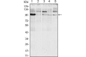 Western blot analysis using ERN1 mouse mAb against Raji (1), A431 (2), Jurkat (3), Hela(4) and HEK293 (5) cell lysate.
