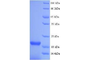 SDS-PAGE (SDS) image for NCAP (AA 1-168), (Extracellular) protein (His tag) (ABIN5714162) (NCAP (AA 1-168), (Extracellular) protein (His tag))