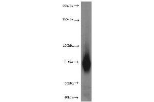 Western Blotting (WB) image for anti-Hepatic and Glial Cell Adhesion Molecule (HEPACAM) antibody (ABIN2932707) (HEPACAM antibody)