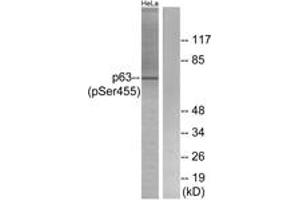 Western blot analysis of extracts from HeLa cells treated with TNF 2500U/ML 30', using p63 (Phospho-Ser455) Antibody. (TCP1 alpha/CCTA antibody  (pSer455))