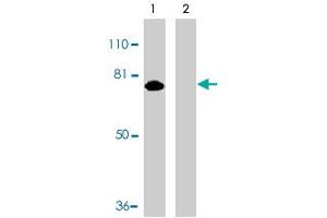 Western blot analysis of MTA2 expression in HeLa whole cell lysates in the absence (lane 1) or presence (lane 2) of blocking peptide with MTA2 polyclonal antibody  at 1 ug /mL . (MTA2 antibody  (AA 652-668))