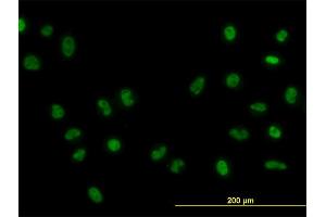 Immunofluorescence of monoclonal antibody to FOXA1 on HeLa cell. (FOXA1 antibody  (AA 367-472))