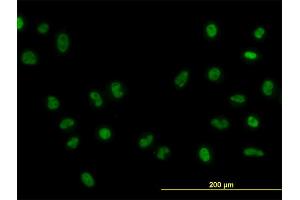 Immunofluorescence of monoclonal antibody to FOXA1 on HeLa cell. (FOXA1 antibody  (AA 367-472))