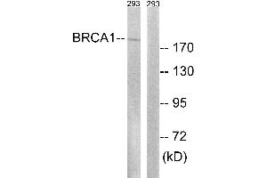 Western blot analysis of extracts from 293 cells, treated with epo (20U/ml, 15mins), using BRCA1 (Ab-1457) antibody. (BRCA1 antibody)