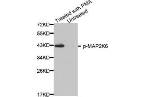 Western blot analysis of extracts from HL60 cells, using phospho-MAP2K6-S207 antibody (MAP2K6 antibody  (pSer207))