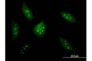Immunofluorescence of purified MaxPab antibody to BXDC2 on HeLa cell. (BRIX1 antibody  (AA 1-353))