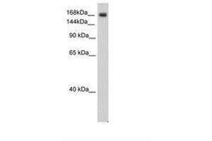 Image no. 2 for anti-Sodium Channel, Voltage-Gated, Type V, alpha Subunit (SCN5A) (AA 1856-1905) antibody (ABIN6736314)