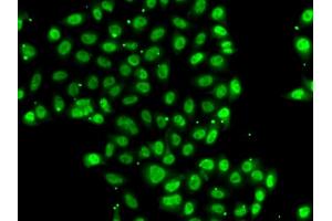 Immunofluorescence analysis of U2OS cells using ZNF148 antibody.