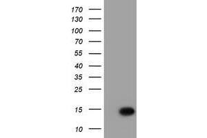 HEK293T cells were transfected with the pCMV6-ENTRY control (Left lane) or pCMV6-ENTRY C17orf37 (Right lane) cDNA for 48 hrs and lysed. (C17orf37 antibody)