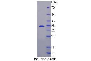 SDS-PAGE analysis of Mouse IHPK3 Protein. (IP6K3 Protein)