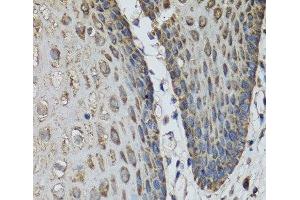 Immunohistochemistry of paraffin-embedded Human esophagus using IL36G Polyclonal Antibody at dilution of 1:100 (40x lens).