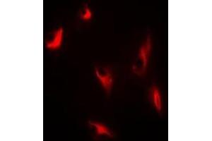 Immunofluorescent analysis of Thymidine Phosphorylase staining in A549 cells. (Thymidine Phosphorylase antibody)