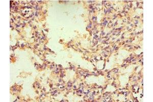 Immunohistochemistry of paraffin-embedded human lung tissue using ABIN7161903 at dilution of 1:100 (NR2C1 antibody  (AA 1-240))