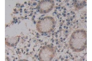 Detection of MPG1 in Human Stomach Tissue using Polyclonal Antibody to Macrophage Expressed Gene 1 Protein (MPG1) (MPEG1 antibody  (AA 313-580))