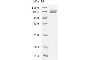 Prosaposin (PSAP) (AA 17-557), (full length) protein (His tag)