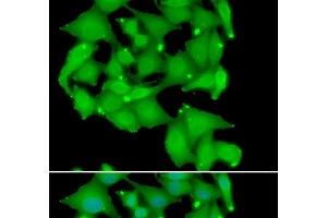 Immunofluorescence analysis of A549 cells using PRKD3 Polyclonal Antibody (PRKD3 antibody)