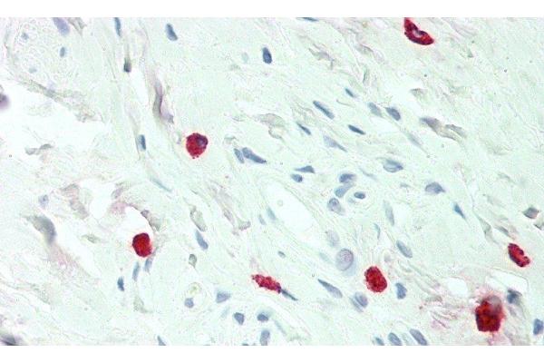 Histamine antibody