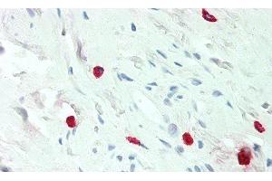Detection of HA in Human Mast Cells of Colon Tissue using Monoclonal Antibody to Histamine (HA) (Histamine antibody)